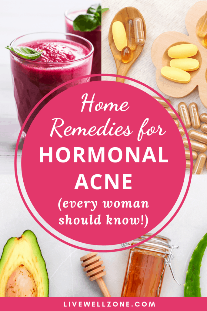 Home Remedies For Hormonal Acne Every Woman Should Know Live Well Zone 0614