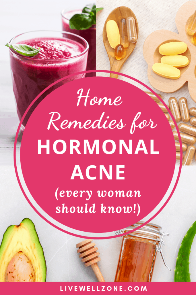 Home Remedies For Hormonal Acne Every Woman Should Know Live Well Zone 