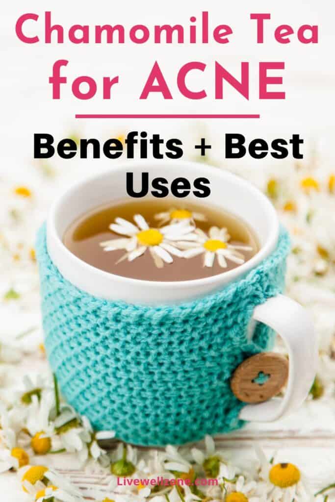pin for chamomile tea for acne