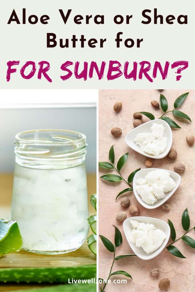 pin for aloe vera or shea butter for sunburn