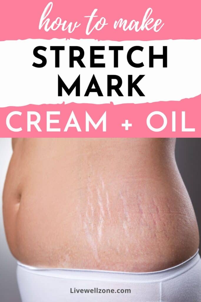 pin for how to make stretch mark cream and oil