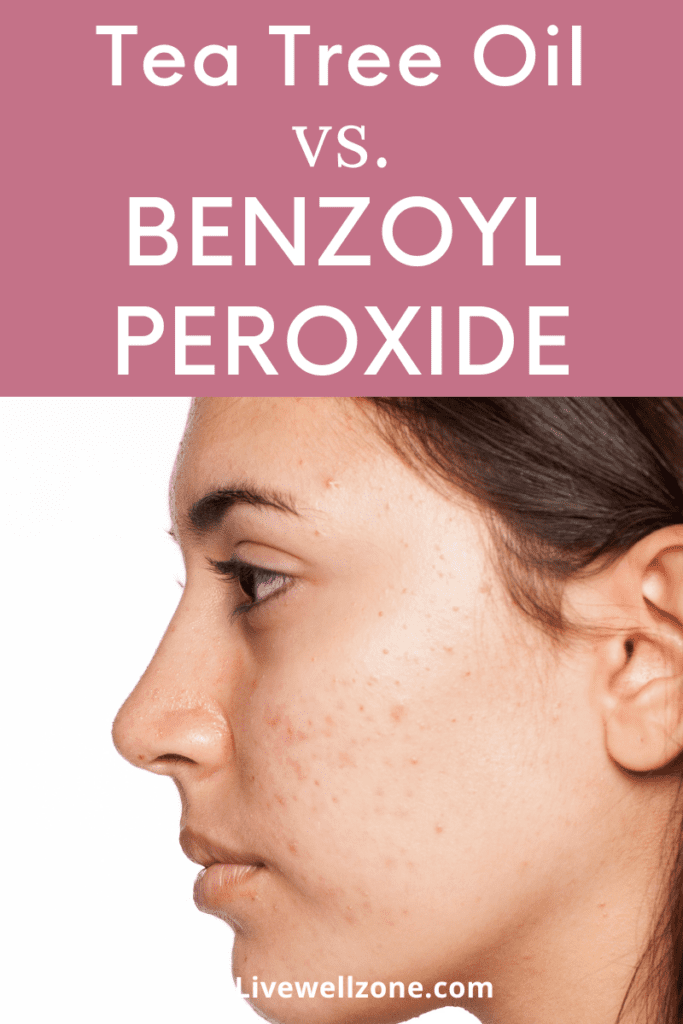 pin for tea tree oil vs benzoyl peroxide